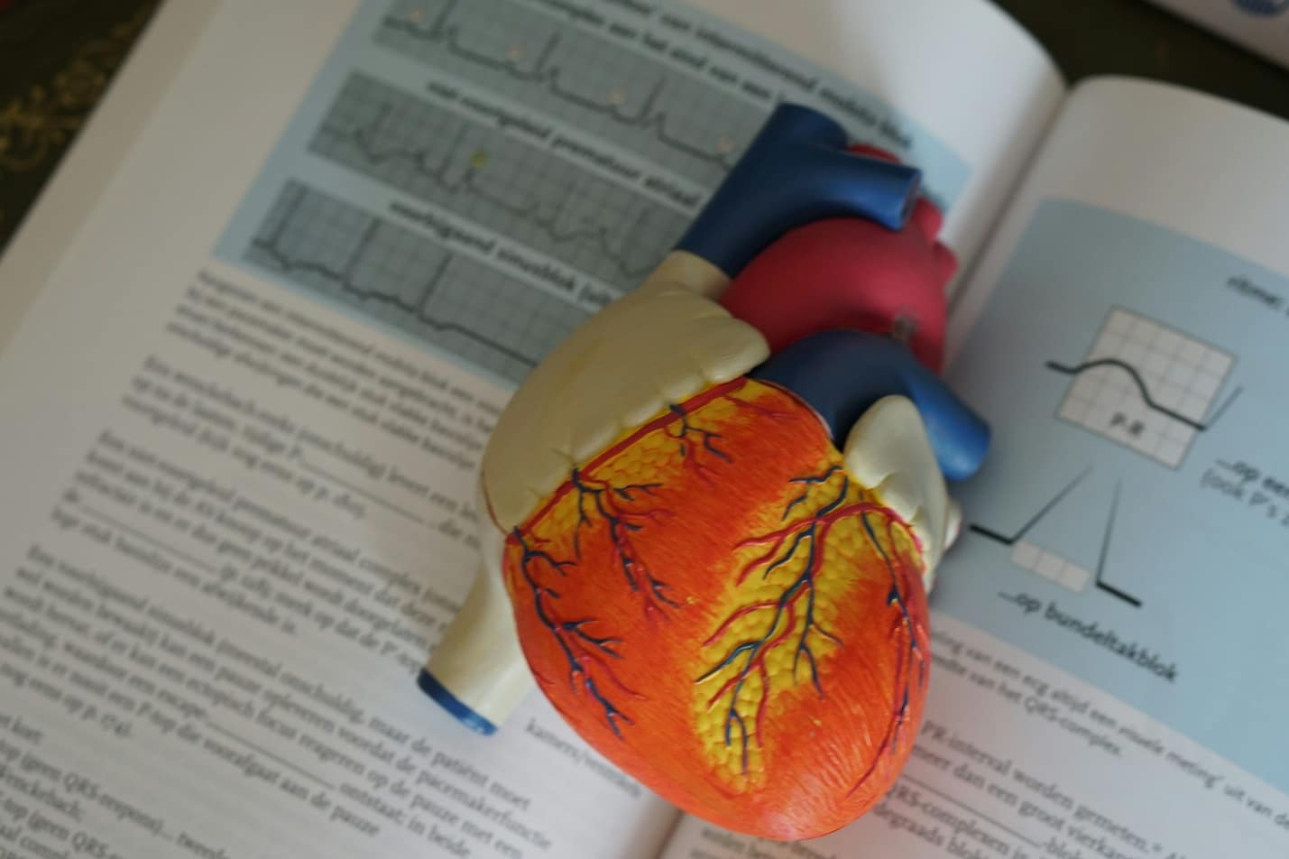 An anatomical heart model placed on a medical textbook illustrating the cardiovascular system and the impact of hypertension